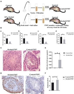 Chronic alcohol-induced dysbiosis of the gut microbiota and gut metabolites impairs sperm quality in mice